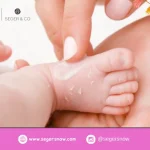 Bagaimana Krim Bayi Dapat Membantu Mengatasi Kulit Sensitif pada Bayi
