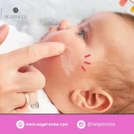 Cara Tepat Menggunakan Krim Bayi untuk Mencegah Ruam pada Kulit Sensitif