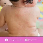 Cara Memilih Baby Cream Anti Nyamuk yang Aman untuk Kulit Bayi