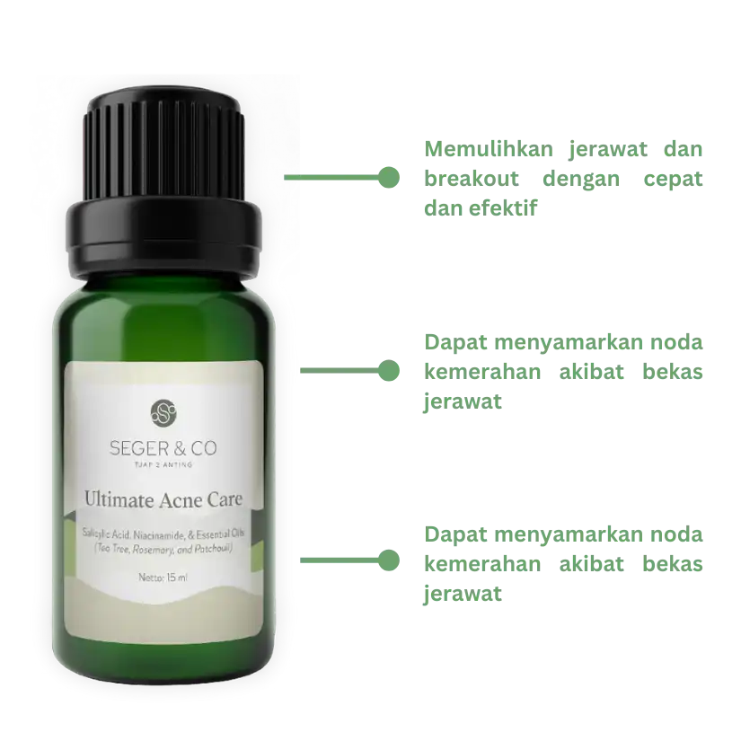 Obat Jerawat paling ampuh