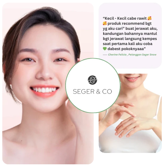 Obat Jerawat paling ampuh